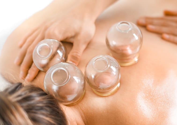 Cupping